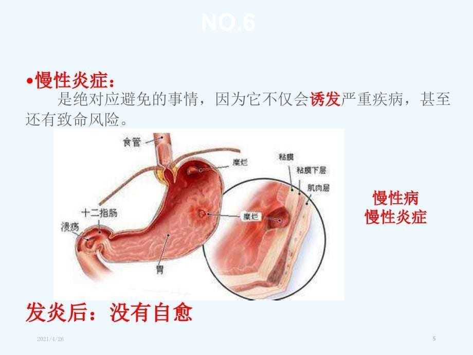 慢性炎症_第5页