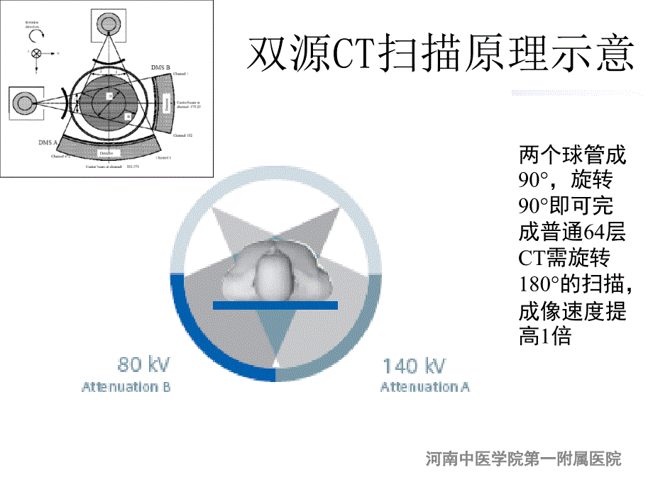 双源CT冠脉成像与冠脉造影_第4页