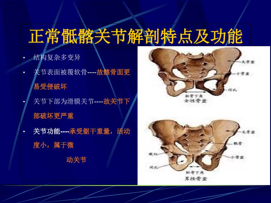 AS骶髂关节病变的CT诊断文档资料_第1页