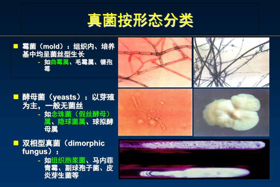 侵袭性肺曲霉病_第2页