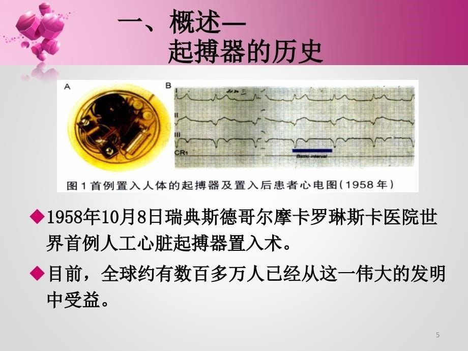 推荐精选起搏器的护理_第5页