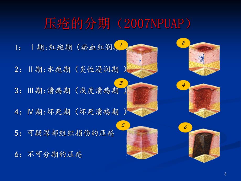 围手术期压疮ppt参考课件_第3页