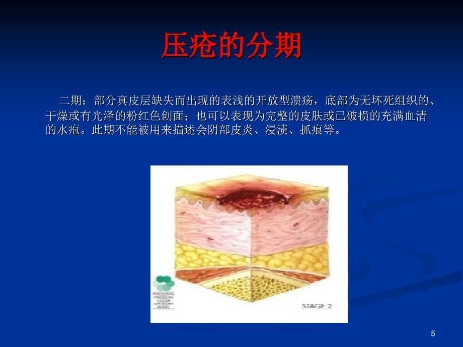 围手术期压疮ppt参考课件_第5页