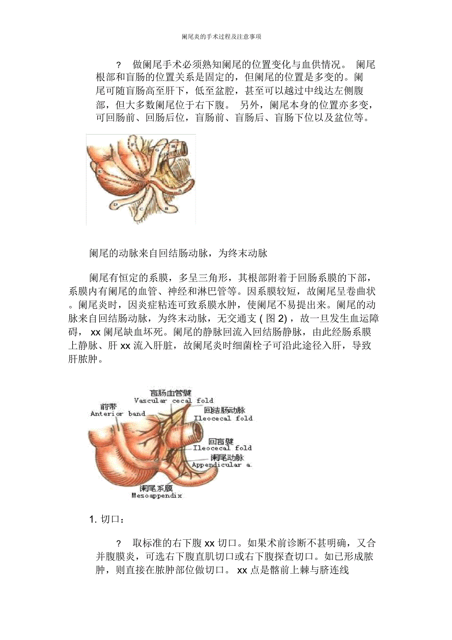 阑尾炎的手术过程及注意事项_第2页