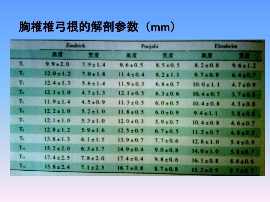 胸椎椎弓根解剖与临床_第5页