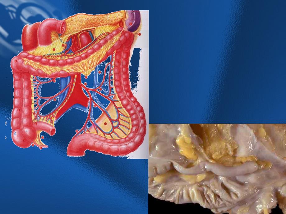 外科学--阑尾炎PPT演示课件_第3页