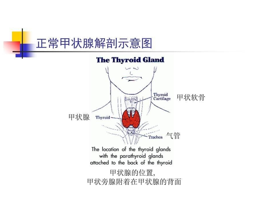 医学医学甲状腺功能亢进症_第5页