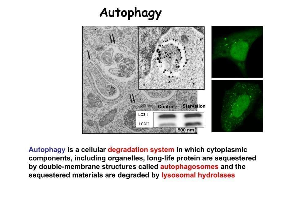 自噬研究的相关知识_第5页