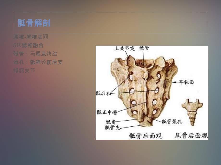 《骶骨肿瘤》ppt课件_第2页