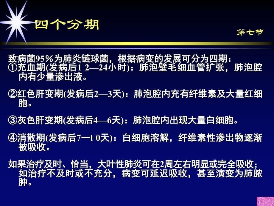 大叶性肺炎诊断和鉴别诊断.ppt_第5页