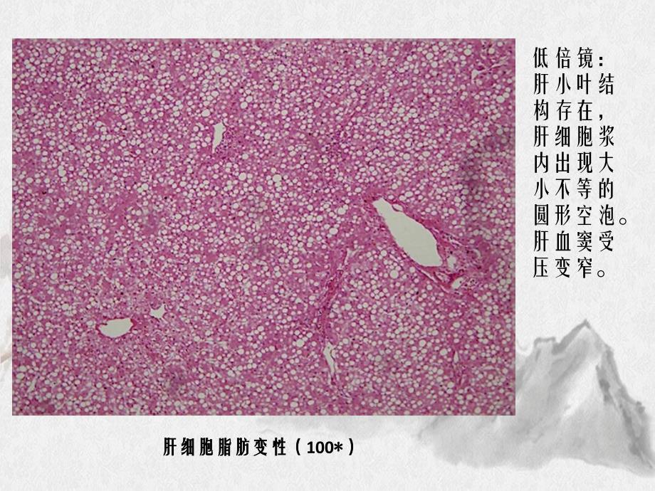 病理切片复习课件_第3页