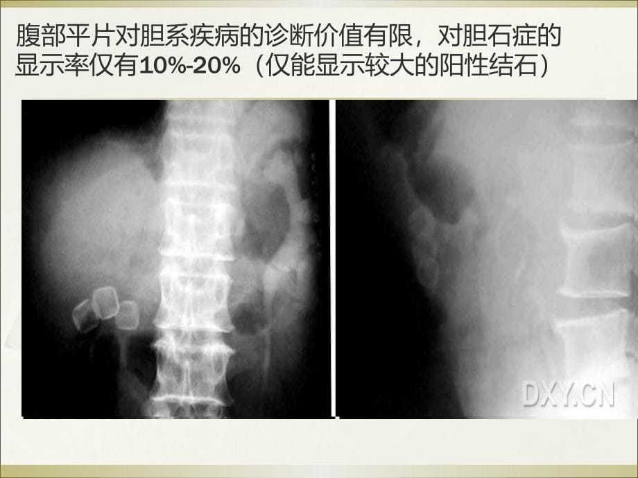 胆道疾病诊疗指南_第5页