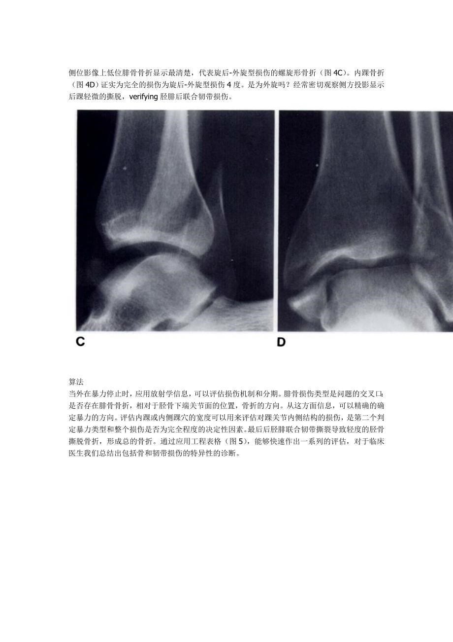 踝关节骨折分类系统(Lauge-Hansen分型).doc_第5页