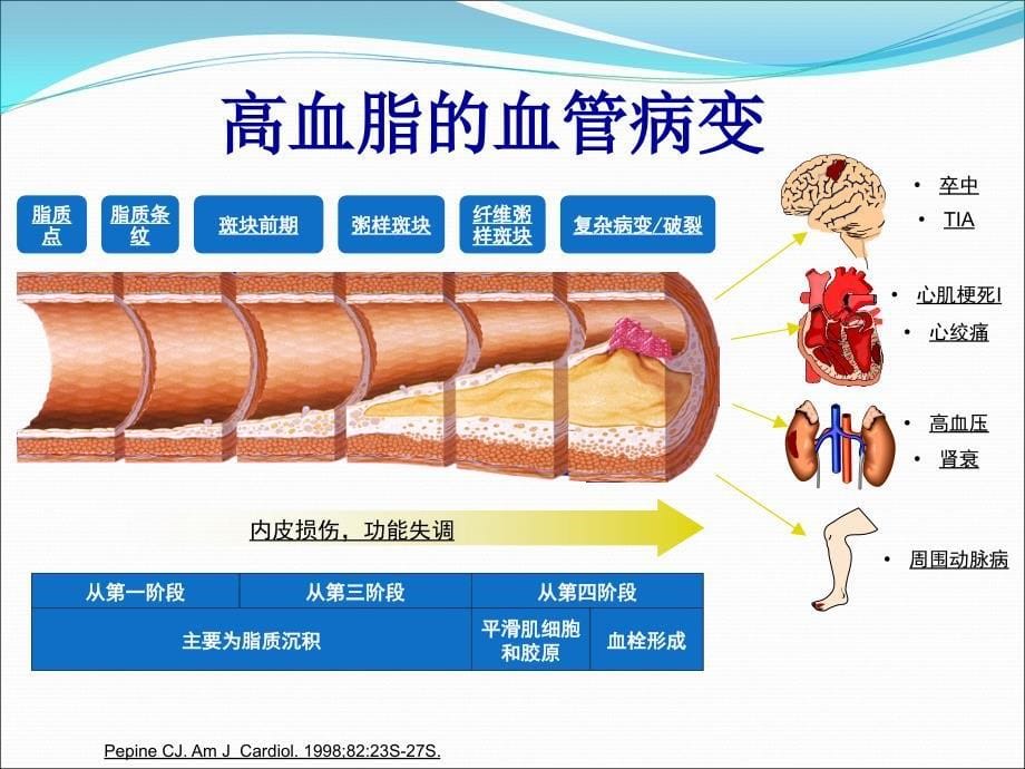 药理学教学课件：抗动脉粥样硬化药_第5页