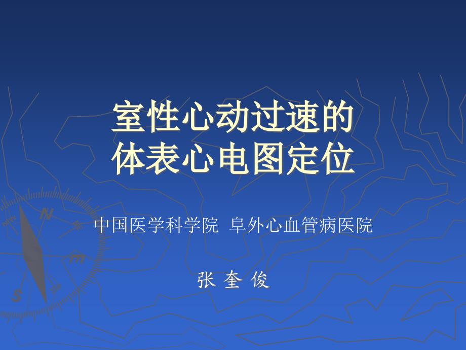 室性心动过速体表心电图定位_第1页