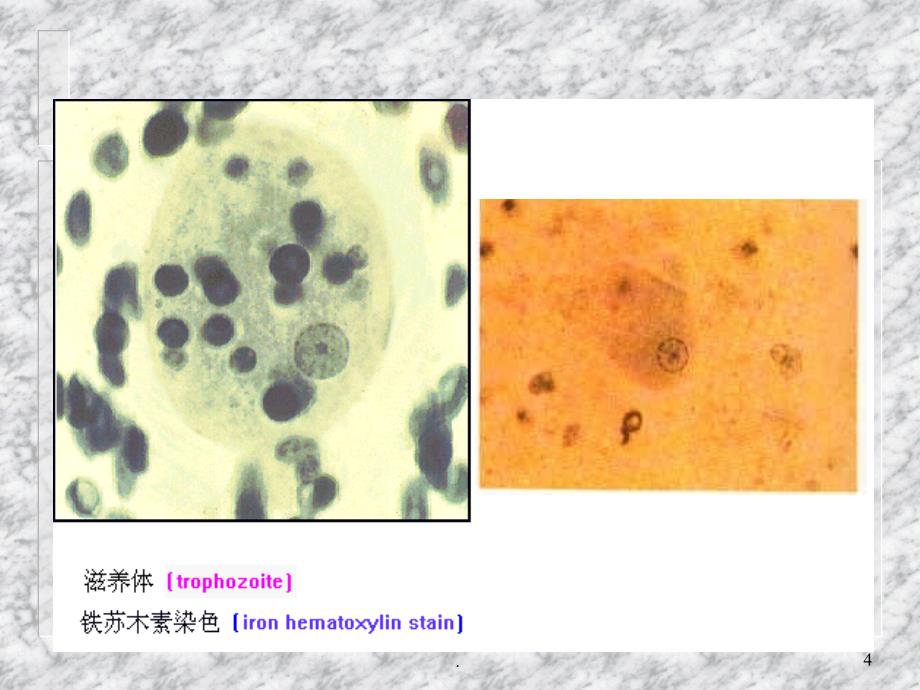 阿米巴ppt演示课件_第4页