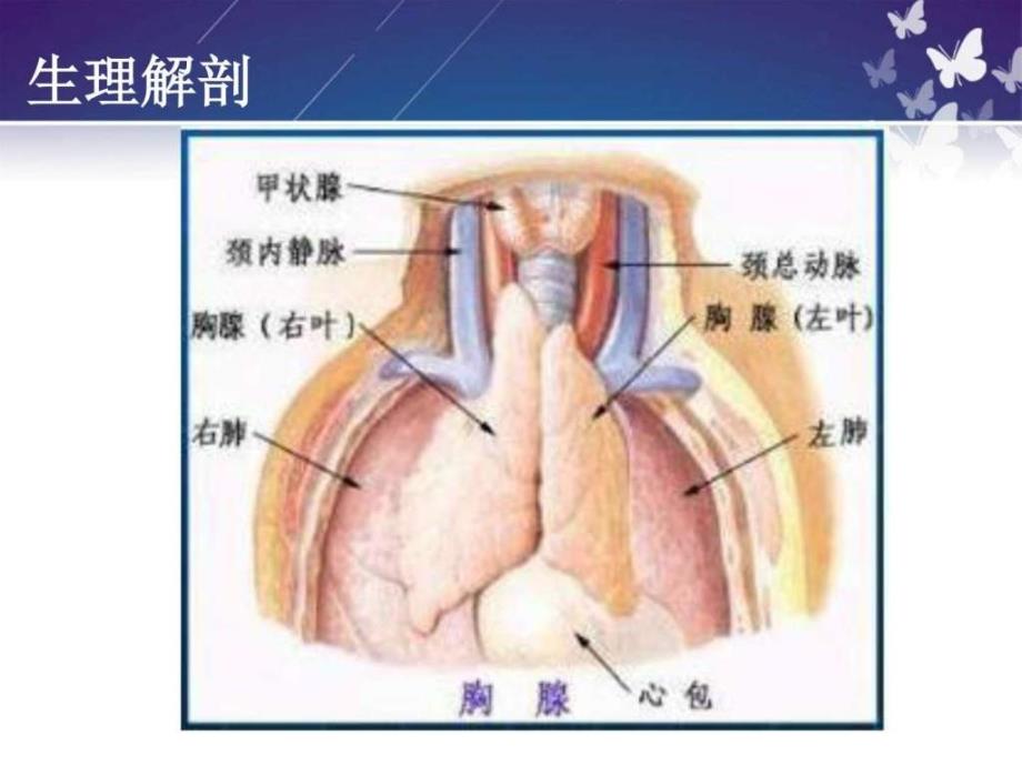 胸腺瘤围手术期护理图文.ppt_第3页