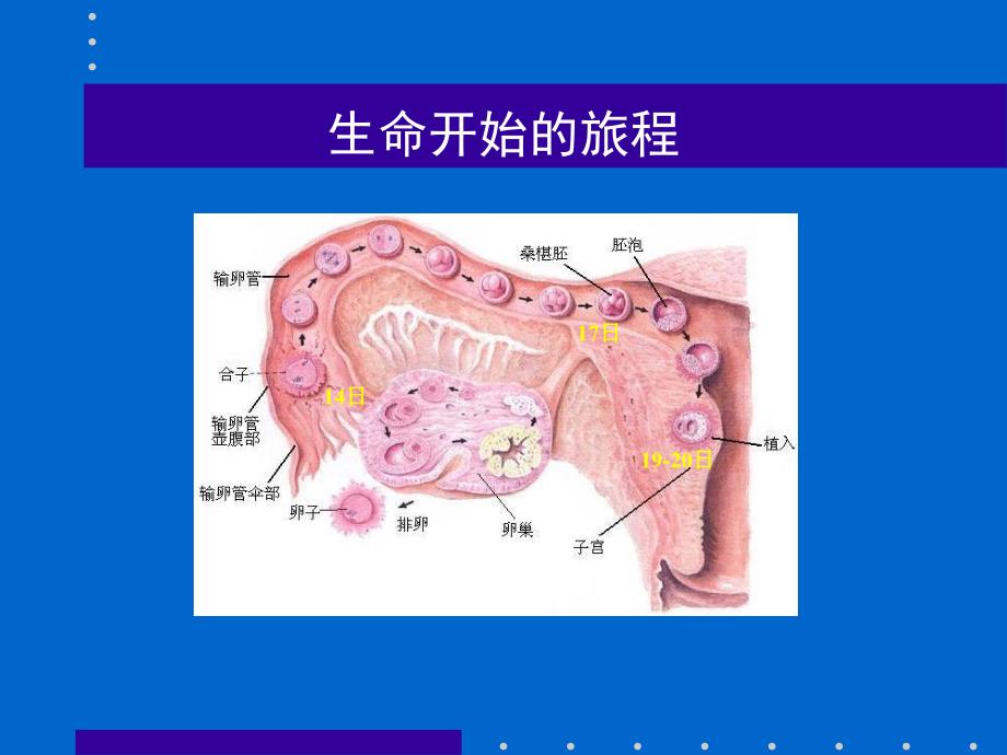 异位妊娠的超声诊断.ppt_第4页