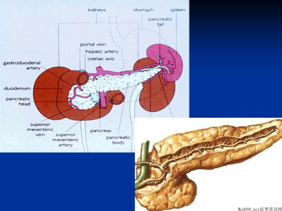 急性胰腺炎PPT课件_第2页