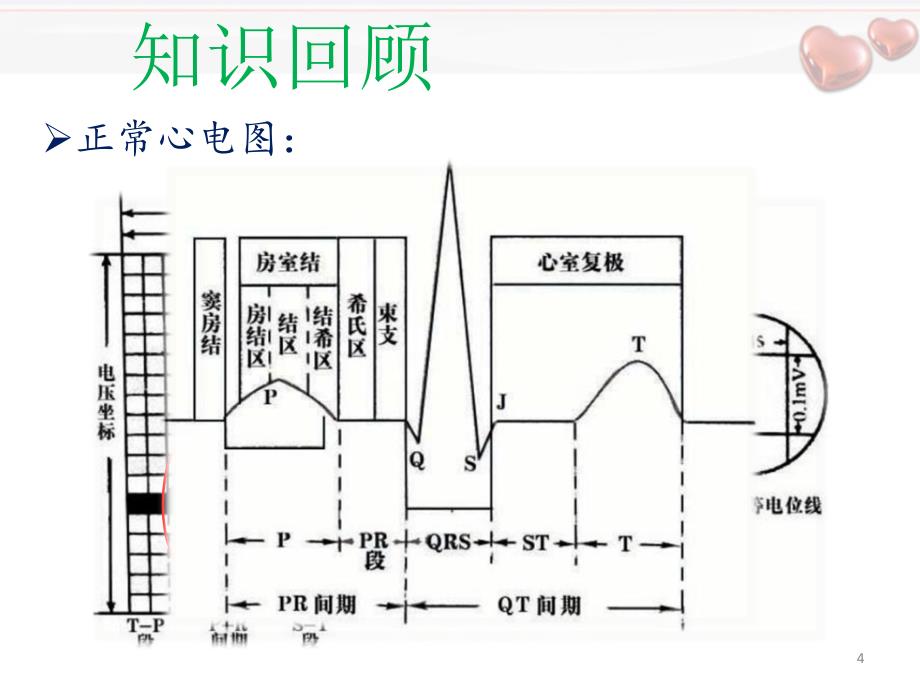 推荐精选室上速护理查房_第4页