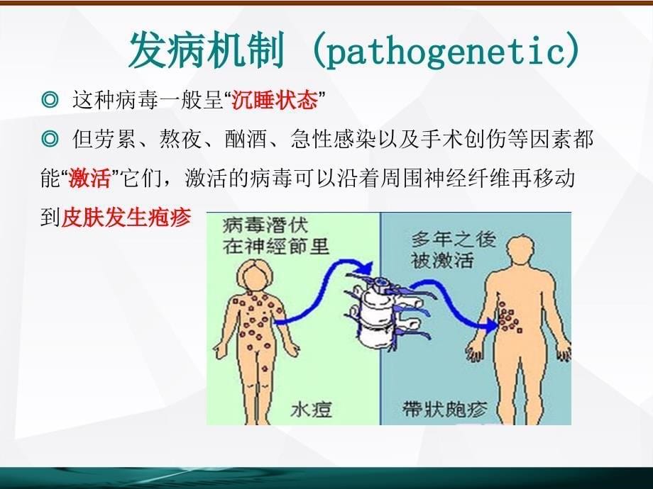 带状疱疹的护理PPT课件_第5页