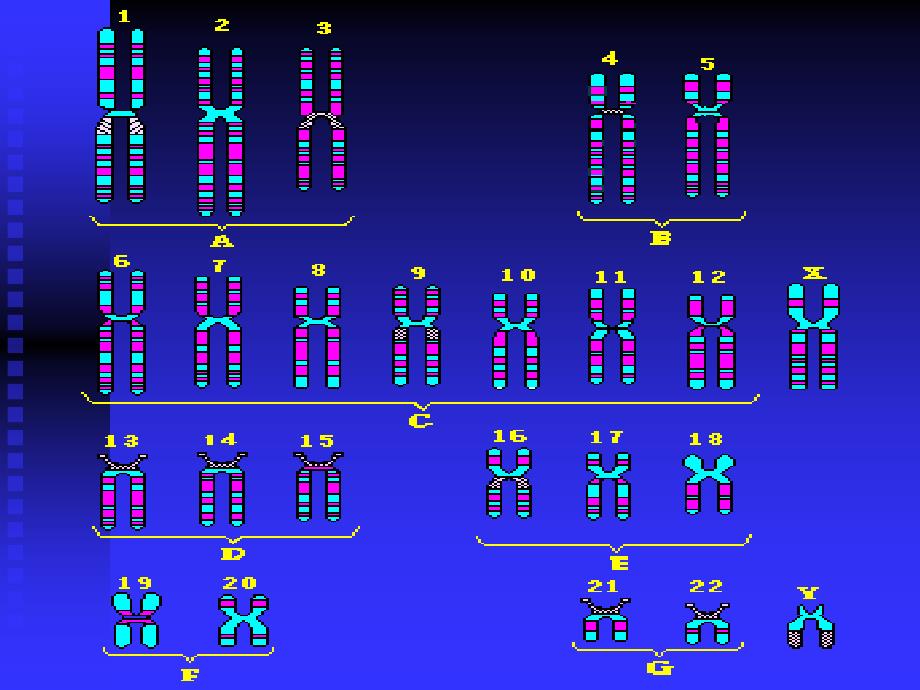 人染色体与染色体病_第4页