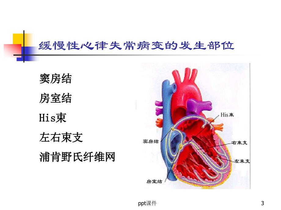 缓慢性心律失常的诊断和治疗ppt课件_第3页