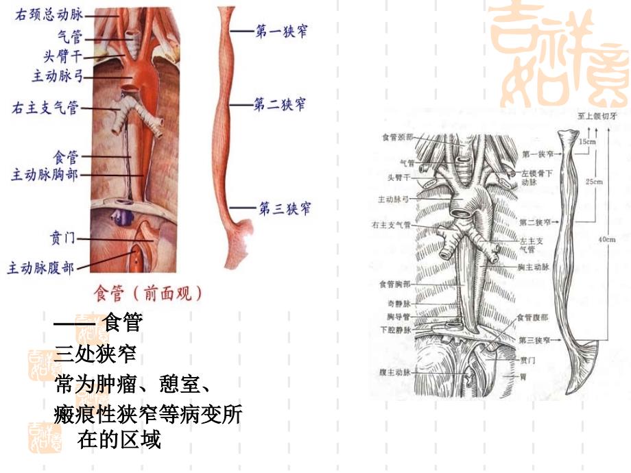 本科食道癌病人的护理_第4页