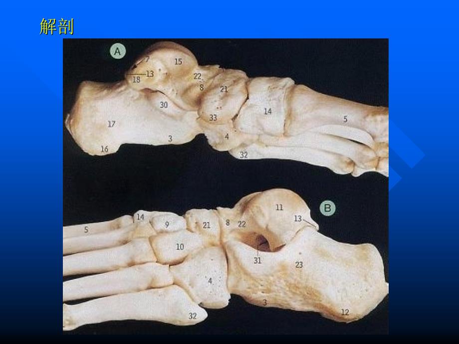 跟骨骨折ppt课件_第4页