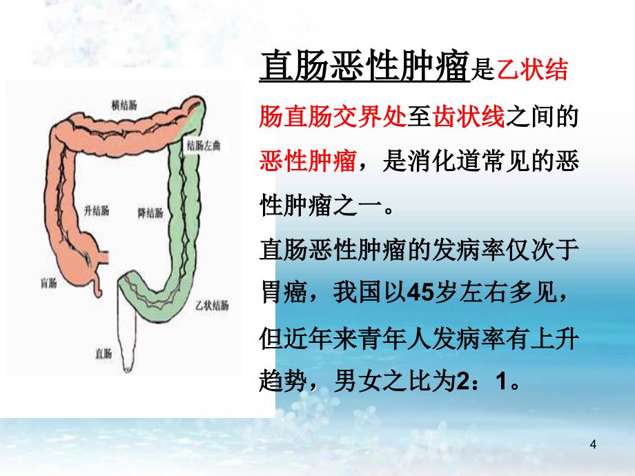 直肠恶性肿瘤护理查房PPT参考幻灯片_第4页