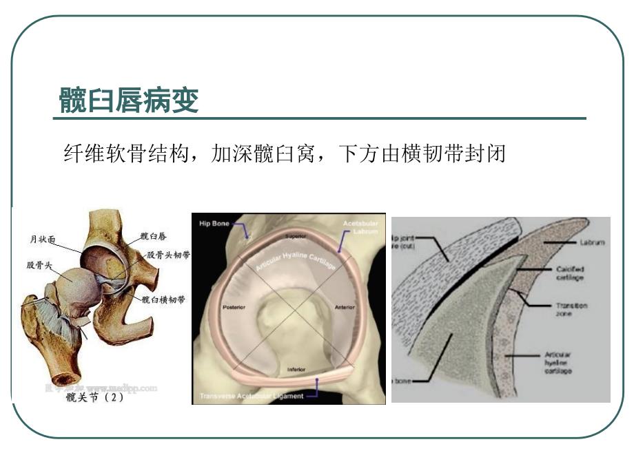 股骨髋关节创伤综合征_第4页