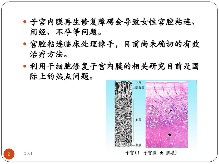 干细胞在子宫内膜损伤修复中的应用_第2页