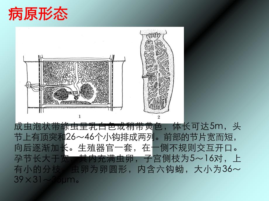 细颈囊尾蚴PPT课件_第3页