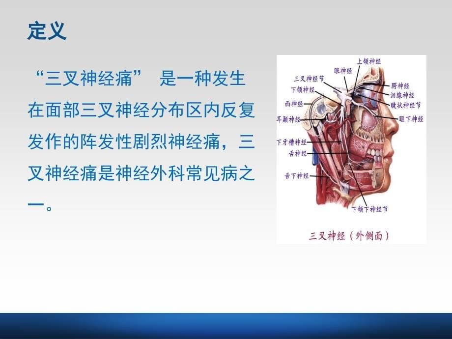 三叉神经痛的护理.ppt_第5页