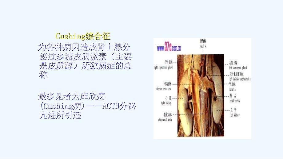 cushing综合症ppt课件_第4页