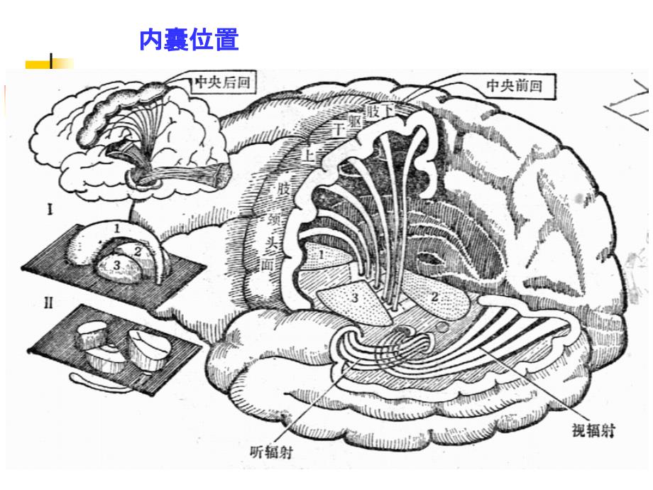 运动障碍疾病_第4页