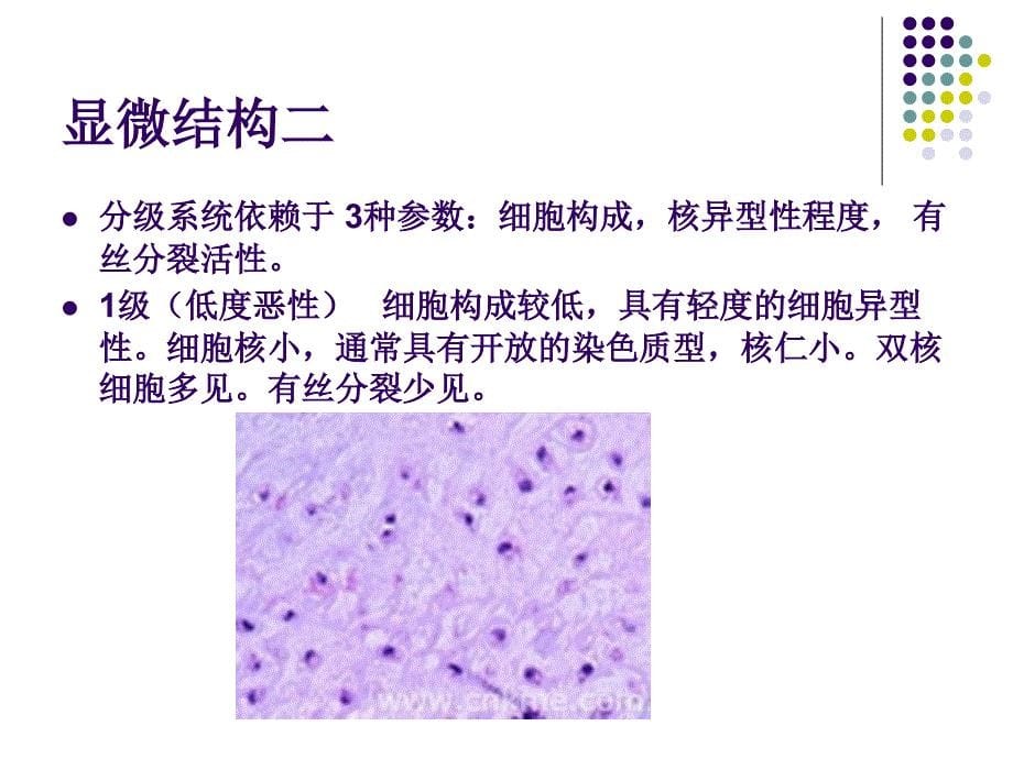 软骨肉瘤的病理及影像学表现_第5页