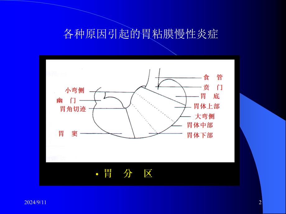 《慢性胃炎定》PPT课件_第2页