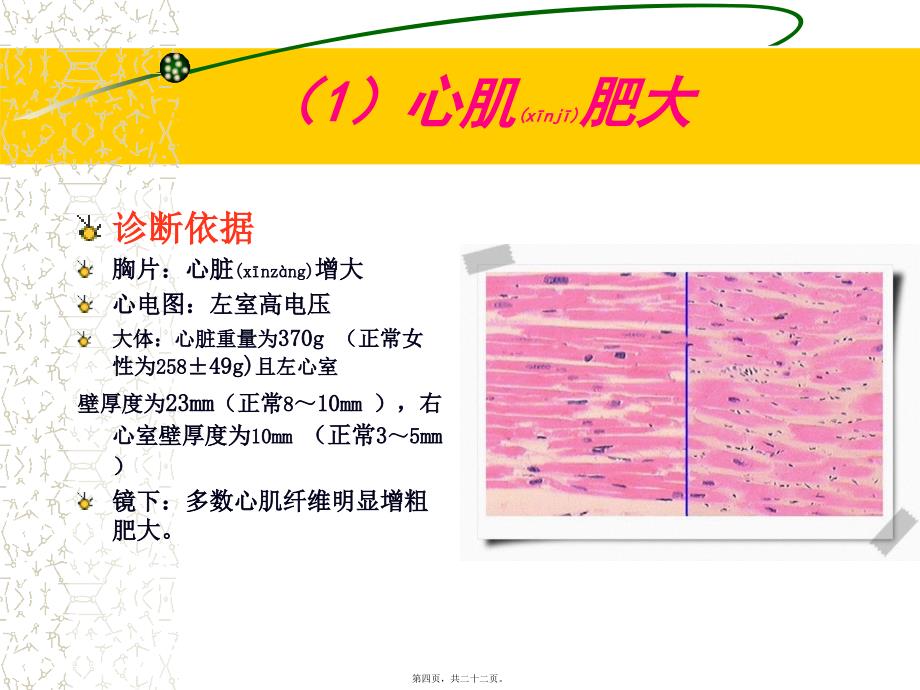 炎症病例讨论1课件_第4页