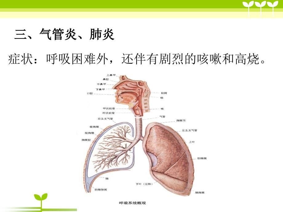 幼儿冬季疾病预防与保健修改版课件_第5页