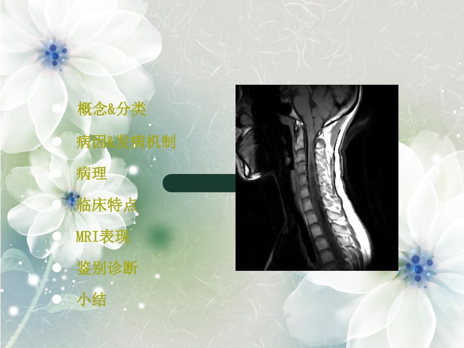 脊髓空洞症MRI表现_第2页