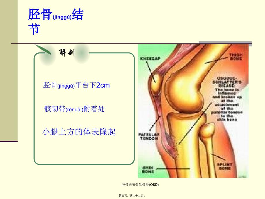 胫骨结节骨软骨炎OSD课件_第3页