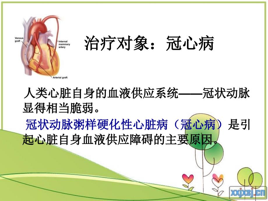 【医药健康】激光心肌血管重建术文档资料_第1页