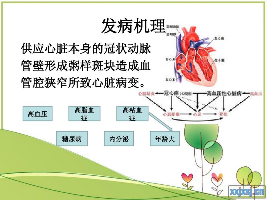 【医药健康】激光心肌血管重建术文档资料_第2页