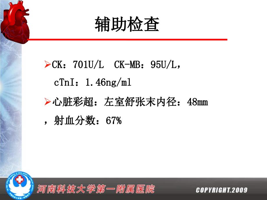 冠状动脉自发壁内血肿1例_第3页