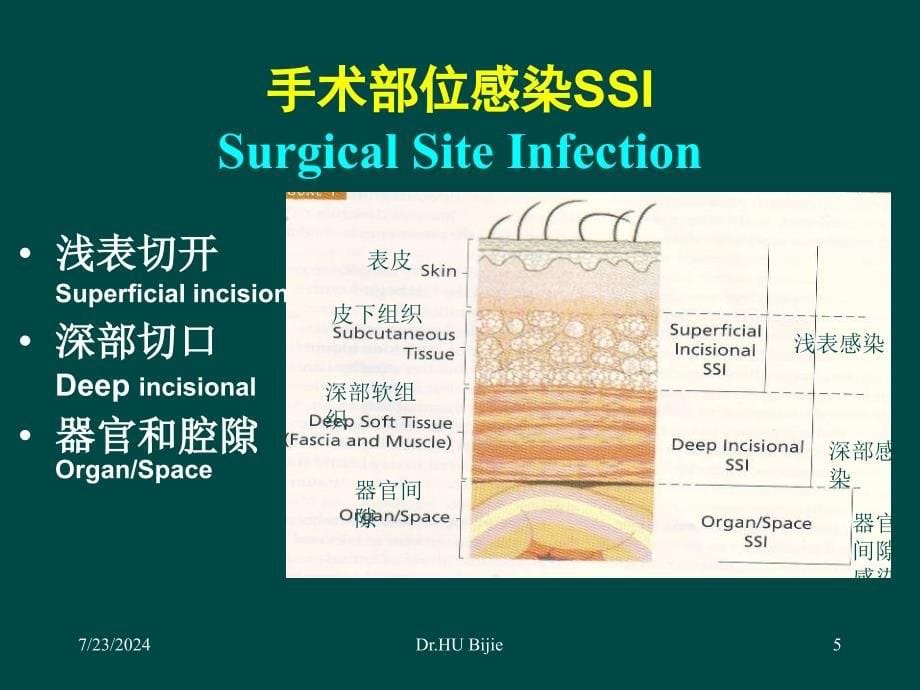 手术部位感染与预防控制课件_第5页