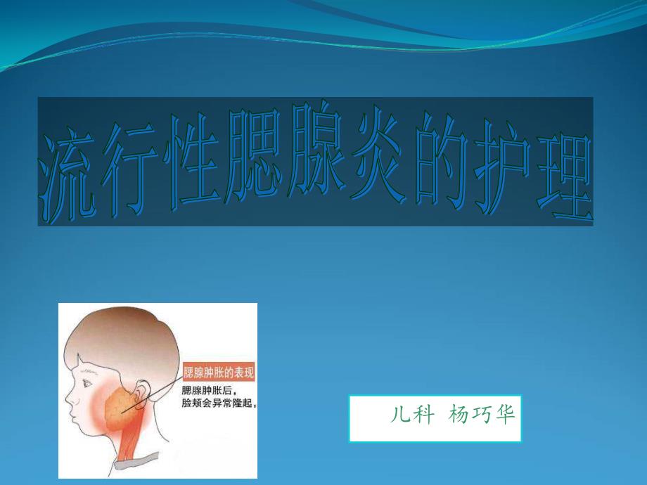 流行性腮腺炎的护理.ppt_第1页