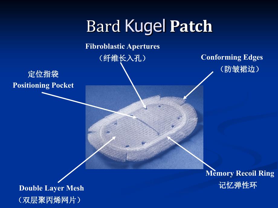 巴德Kugel补片在腹股沟疝及_第4页