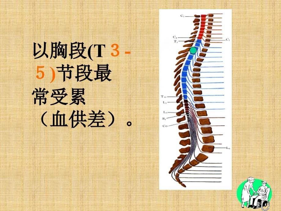 脊髓炎病人的护理_第5页