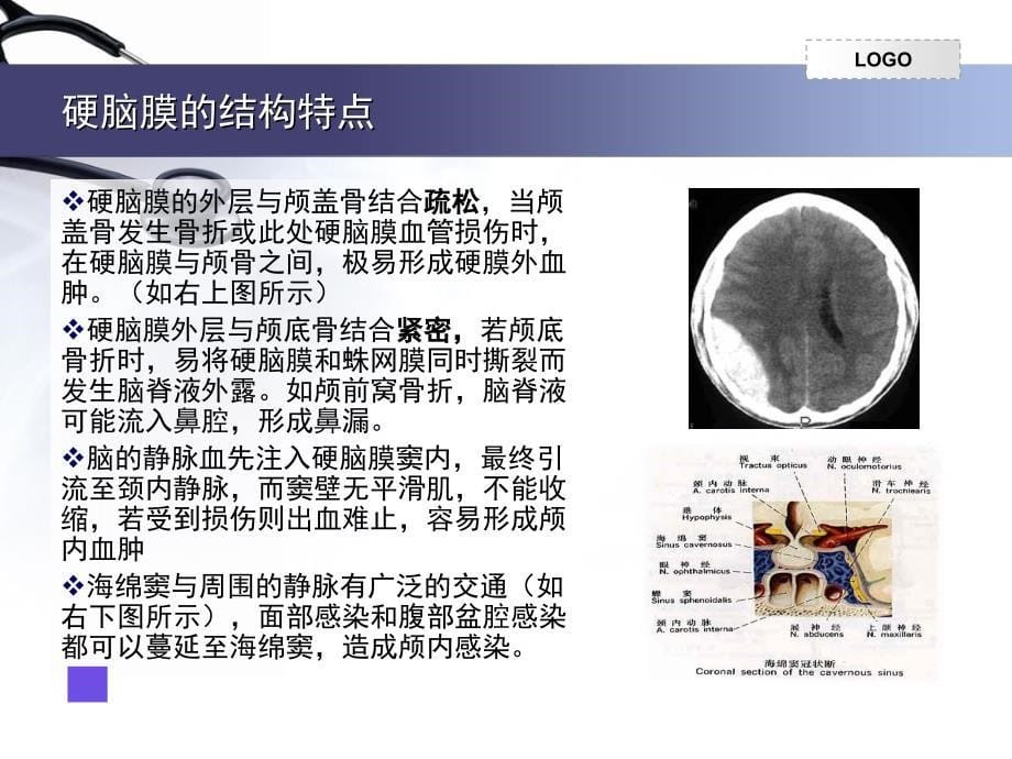 脑膜的解剖课堂PPT_第5页